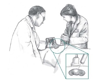 Health care professionals use ultrasound to guide a biopsy needle into the back of a patient lying on a table. An inset shows a closer view of the kidney biopsy.