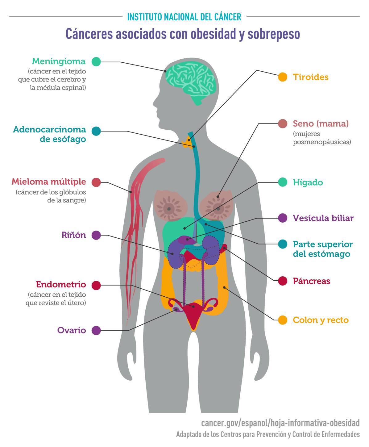 Ilustración de un torso humano, con etiquetas que muestran los diferentes tipos de cáncer asociados con el sobrepeso y la obesidad: tiroides, seno (mujeres posmenopáusicas), hígado, vesícula biliar, parte superior del estómago, páncreas, colon y recto, ovario, endometrio (cáncer en el tejido que reviste el útero), riñón, mieloma múltiple (cáncer de los glóbulos de la sangre), adenocarcinoma de esófago y meningioma (cáncer en el tejido que cubre el cerebro y la médula espinal).