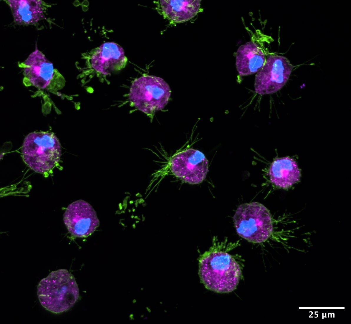 Slide of human iPSC-derived microglia stained for neutral lipids.