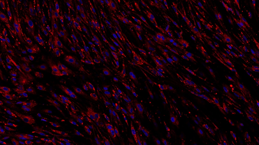 Human induced pluripotent stem cell-derived astrocytes stained for lipid droplets