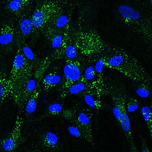 Human induced pluripotent stem cell-derived astrocytes stained for a marker of early endosomes