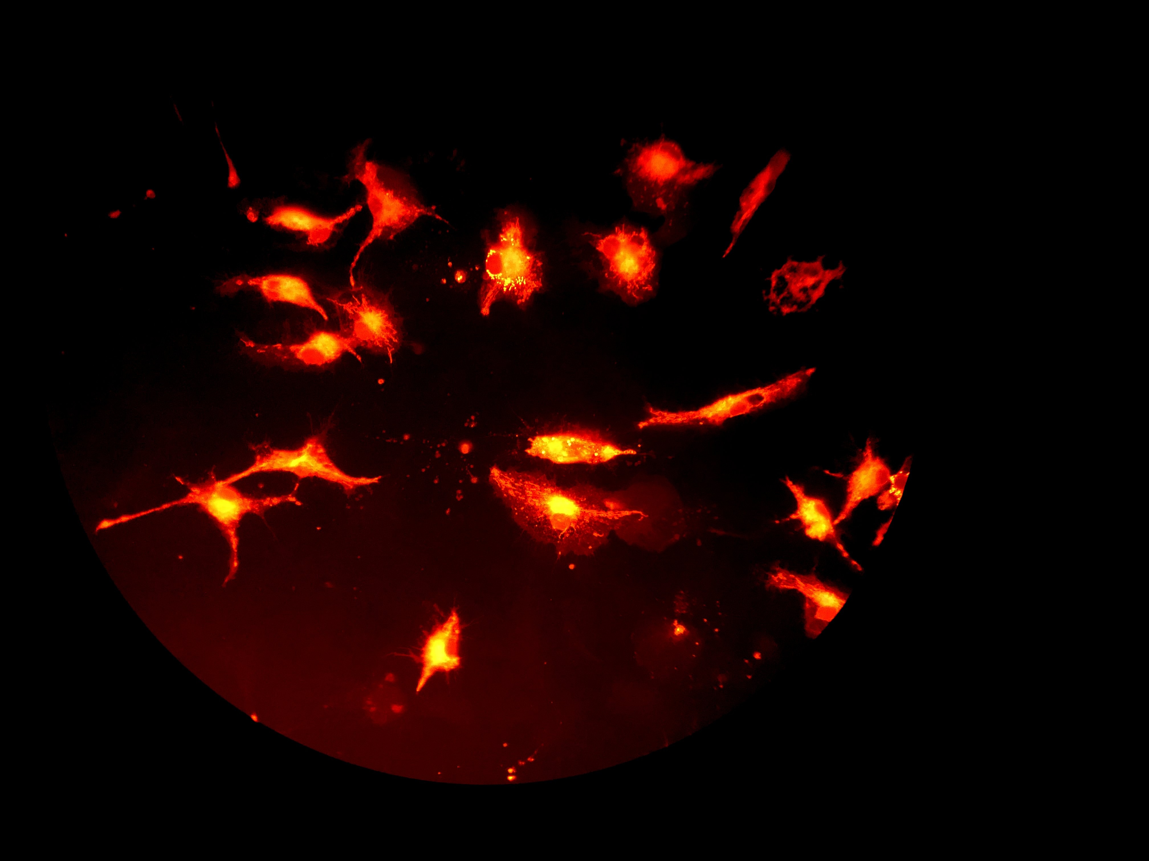 Human induced pluripotent stem cell-derived microglia with a stain for cellular neutral lipids