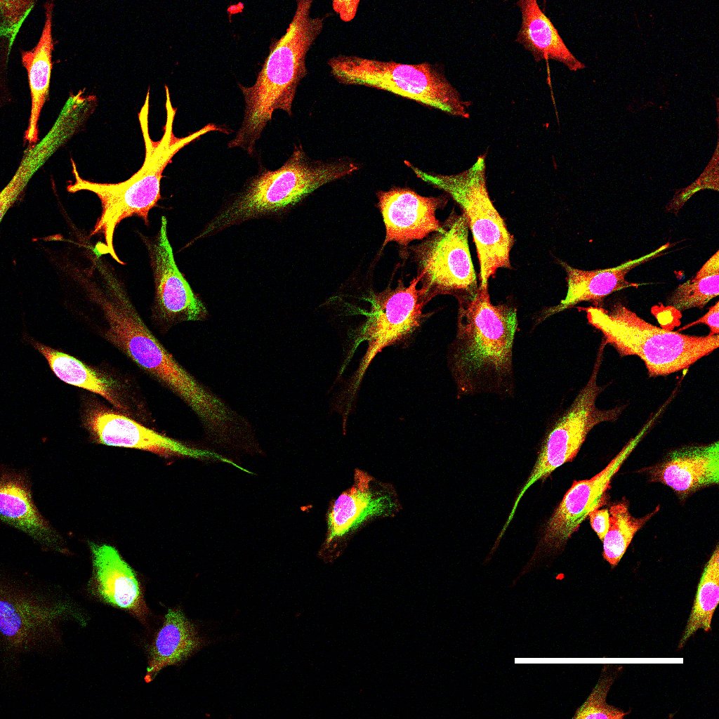 Human induced pluripotent stem cell-derived astrocytes