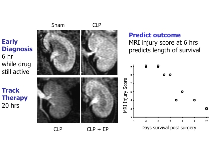 Dendrimer MRI as a biomarker in sepsis.