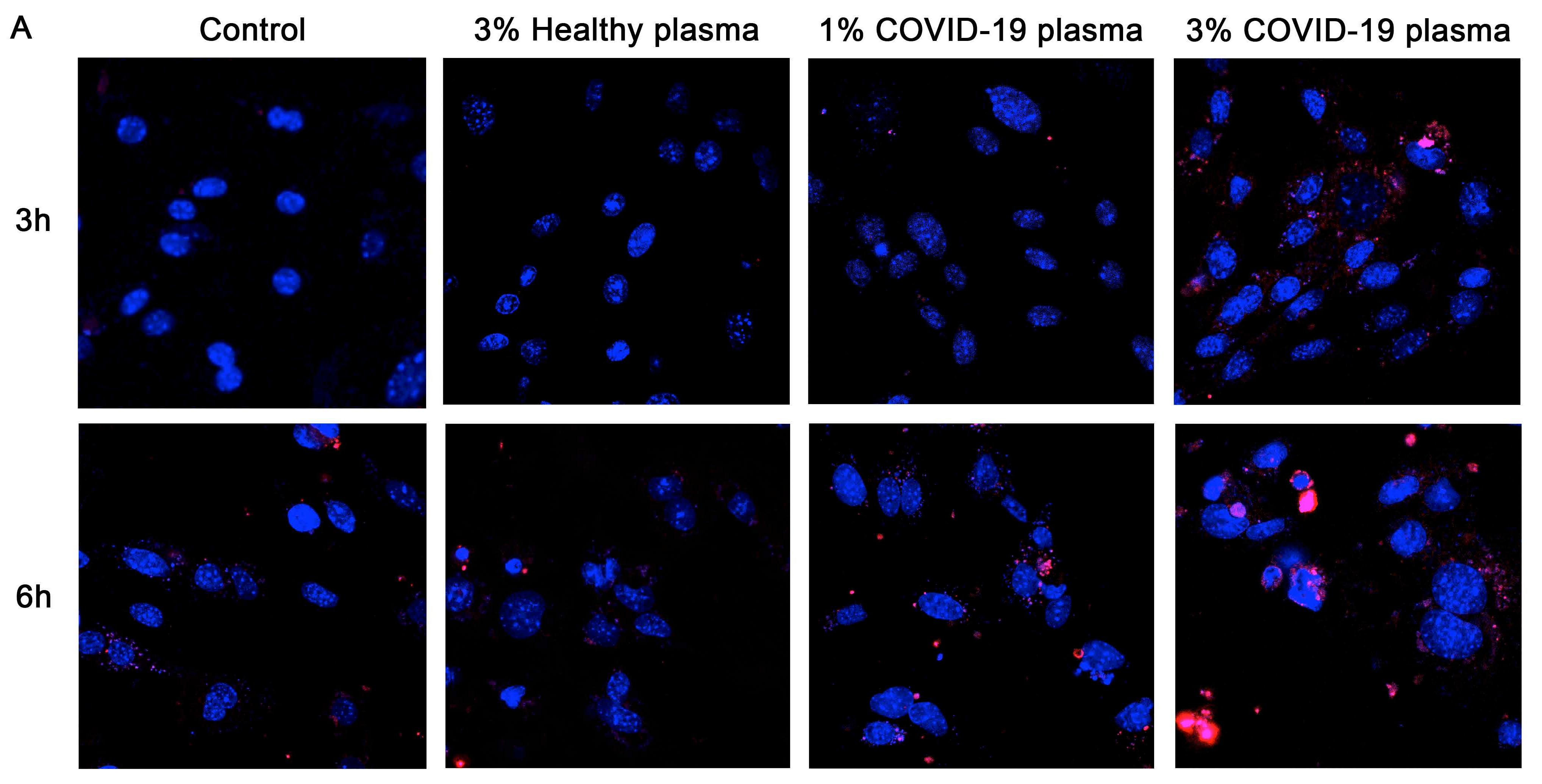 MitoSOX Red control, 3% healthy plasma, 1% COVID-19 plasma, and 3% COVID-19 plasma at 3 and 6 hours