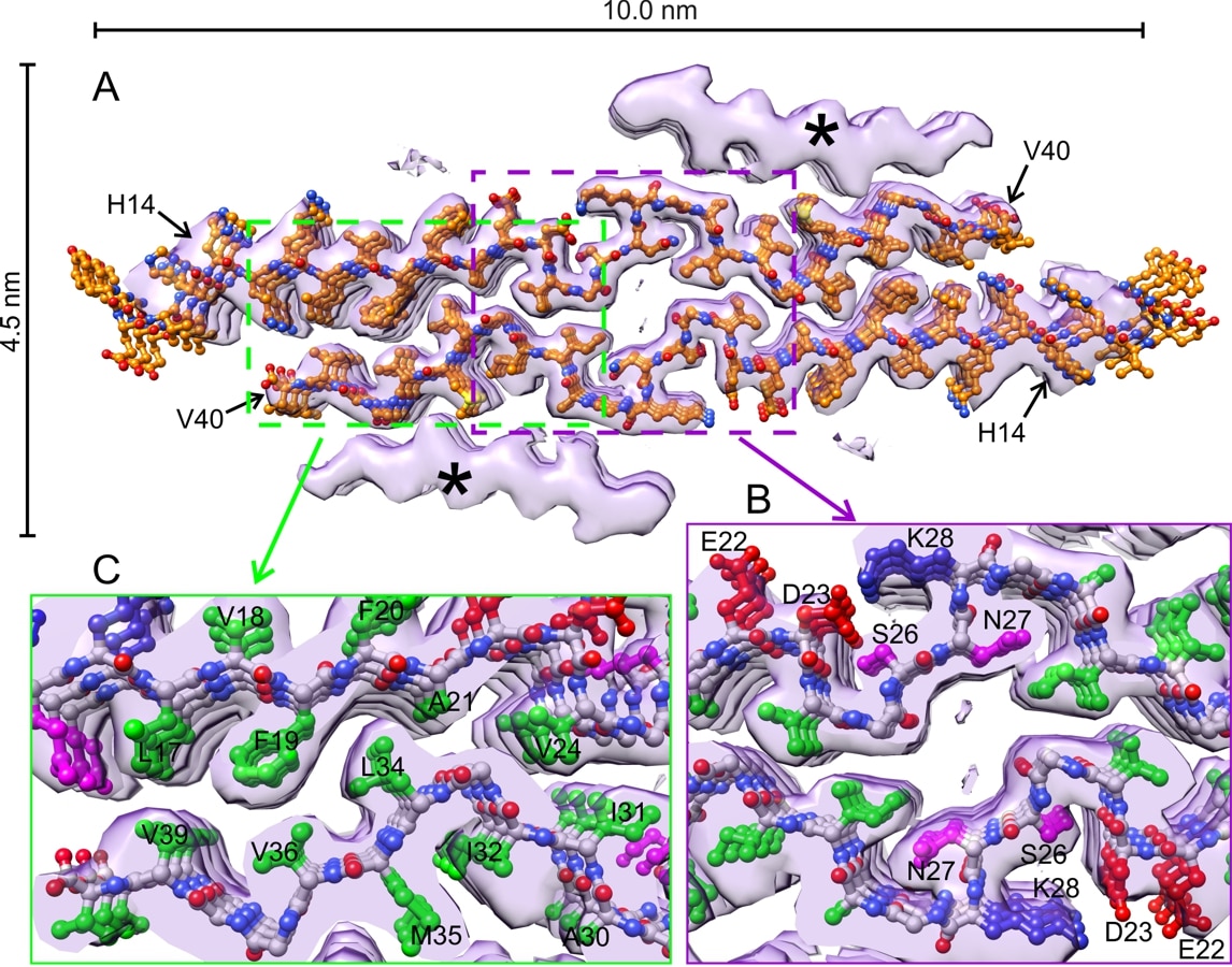 Molecular structure of brain-derived amyloid- fibrils from cryo-electron microscopy